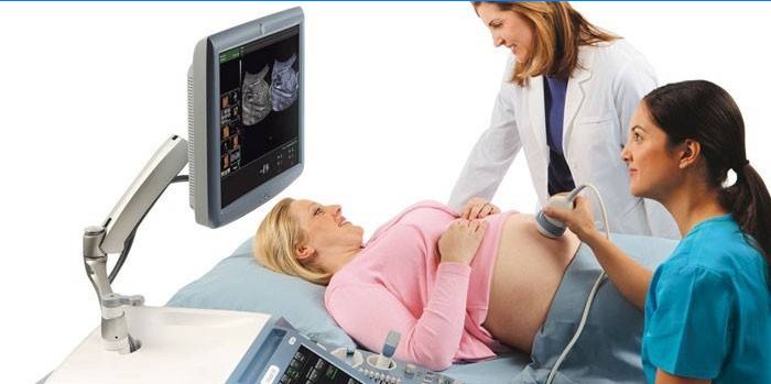 Zwangere vrouw op echografie