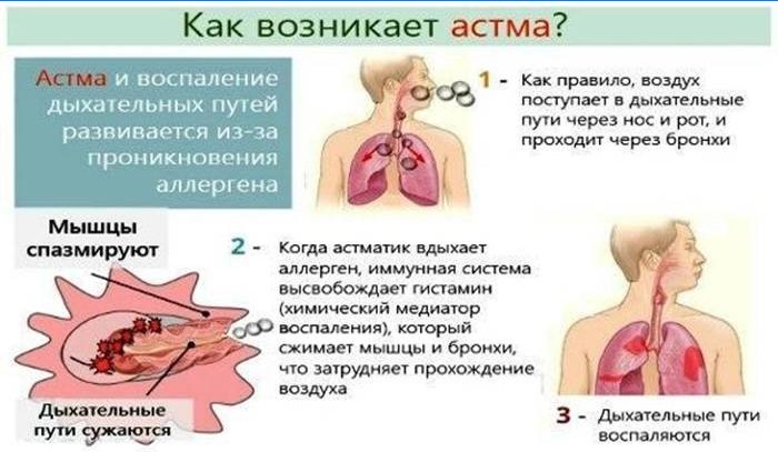 Hoe komt astma voor?