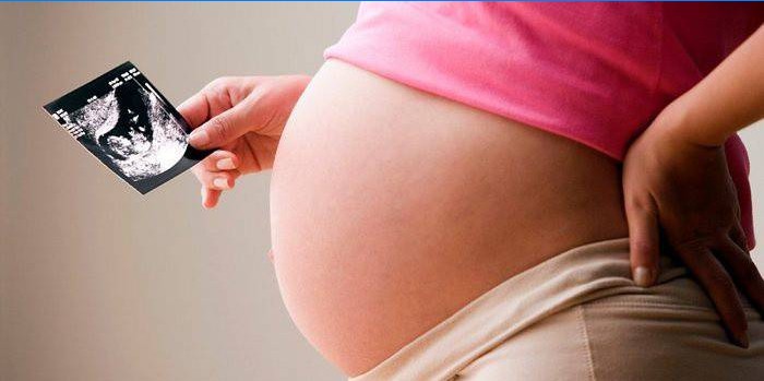 Zwangere vrouw na echografie