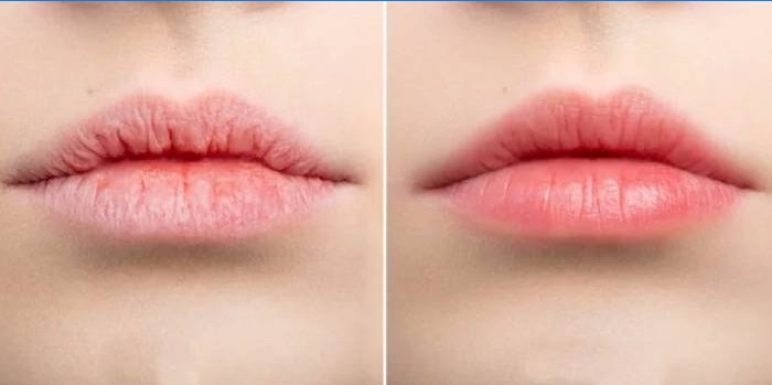 Lippen voor en na het aanbrengen van de balsem